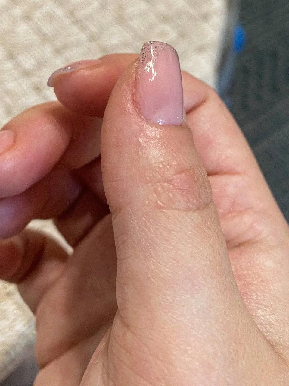 Every woman wants her manicure to look flawless, because our hands are always on display. Gel polish is a great help in this regard. It is a durable coating that retains its aesthetic appearance for weeks and allows you to create designs to suit any taste. However, like any other cosmetic product, gel polish can cause an allergic reaction. It is very important to know how it manifests itself and what to do in such a situation. We will talk about this in this article.