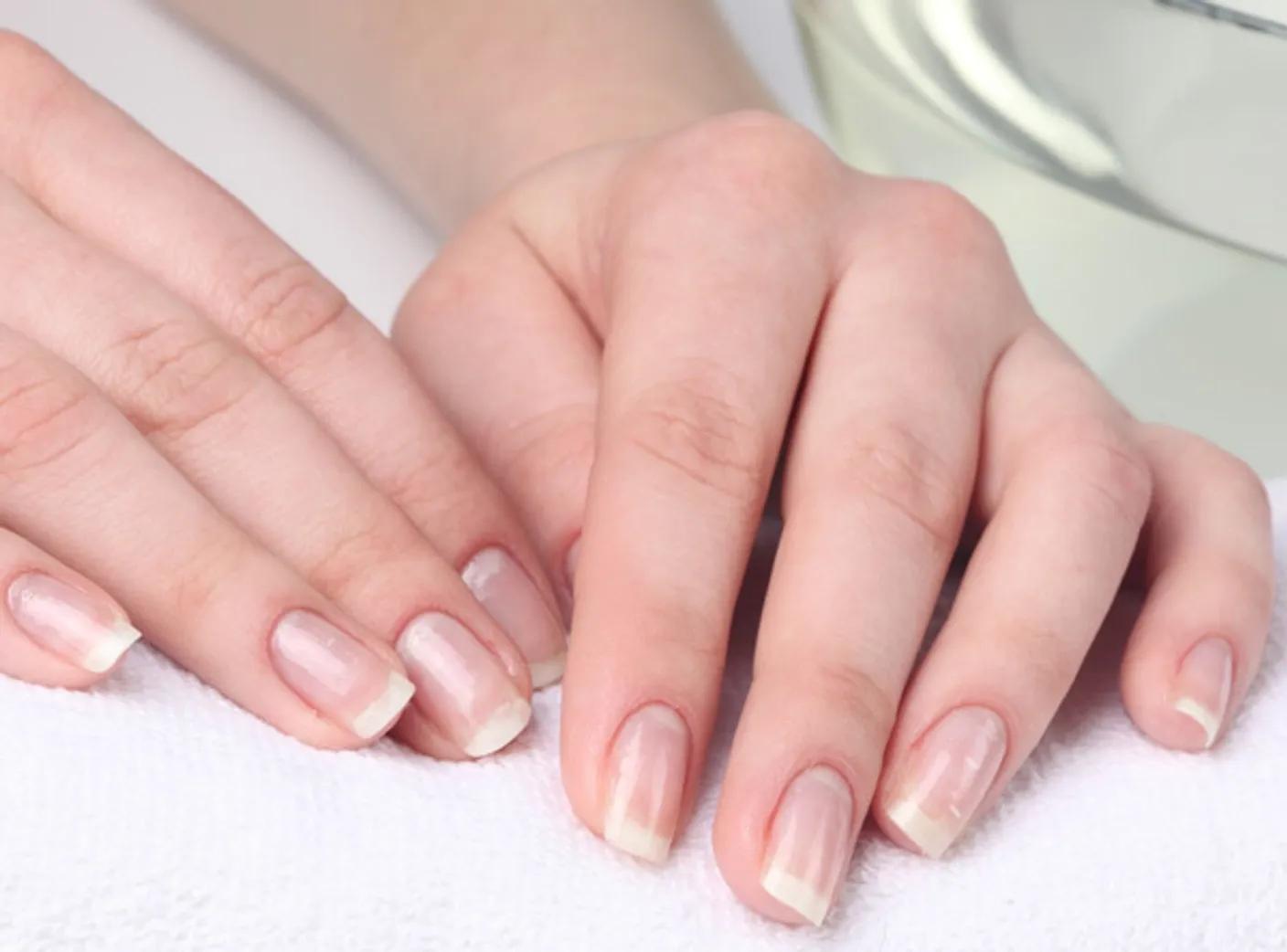 Белые пятна на ногтях — мелкая, но заметная деталь, которая может испортить даже самый изящный маникюр. Они появляются внезапно, не болят и не вызывают дискомфорта. Однако эти небольшие полоски заставляют задуматься, является ли это просто косметическим дефектом или сигналом от организма о внутренних проблемах.
